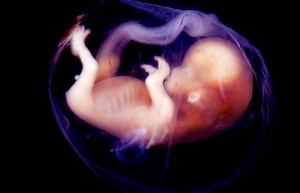 unborn baby